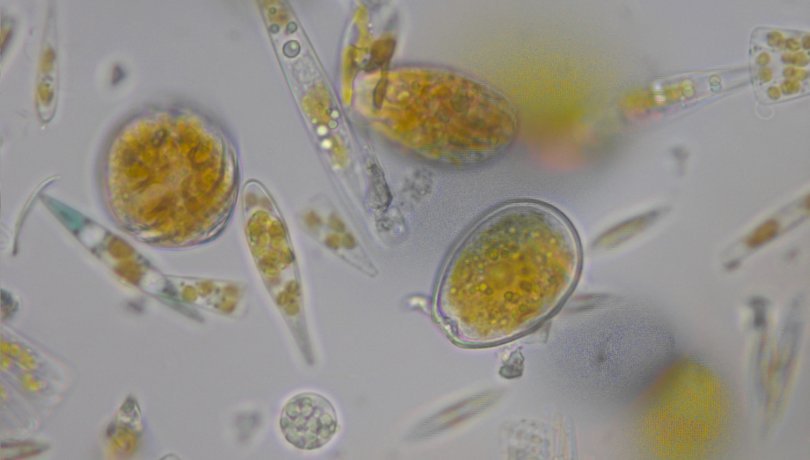 Plankton samples /Albert Reñé (ICM-CSIC)