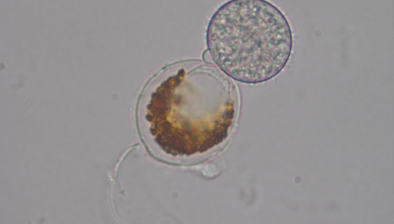 Célula de dinoflagelado infectada por el quítrido ectoparásito Ericiomyces syringoforeus / Albert Reñé (ICM-CSIC)