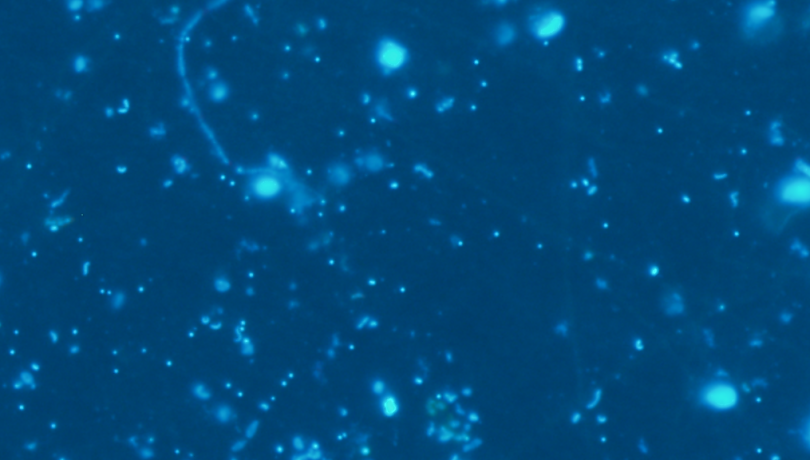 Marine microorganisms play a key role in the regulation and maintenance of life-sustaining biogeochemical cycles on Earth / Clara Ruiz (ICM-CSIC). Marine microorganisms play a key role in the regulation and maintenance of life-sustaining biogeochemical cycles on Earth / Clara Ruiz (ICM-CSIC).