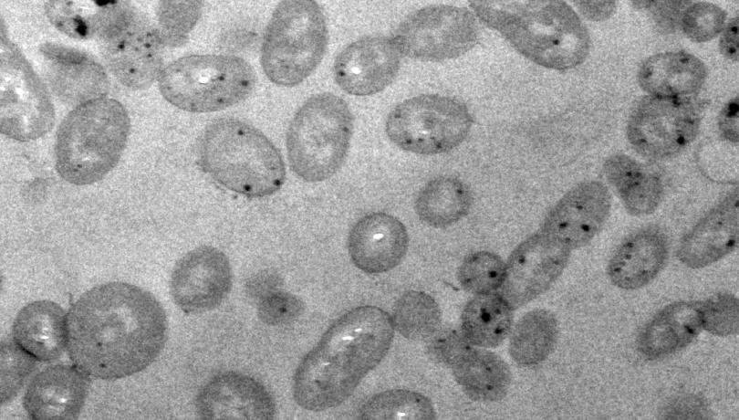 "Alteromonas mediterranea" bacteria growing in a medium with methylmercury obtained by transmission electron microscopy /  ICM-CSIC & UAB.