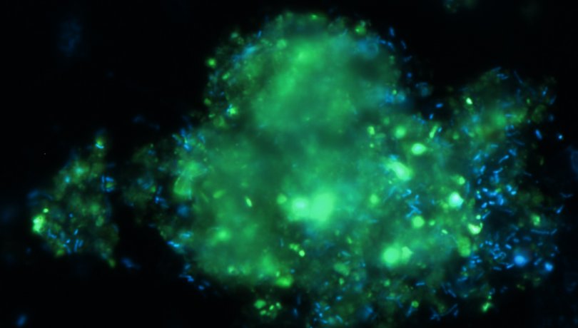 Partícula marina con bacterias (en azul) al microscopio. | Mireia Mestre (ICM-CSIC)