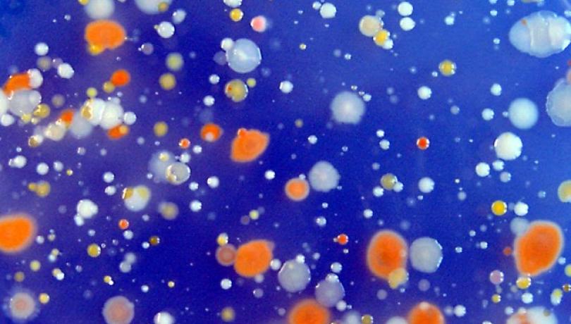 Bacterias aisladas del Mediterráneo, muchas de ellas con proteorodopsina. Imagen: Laura Gómez
