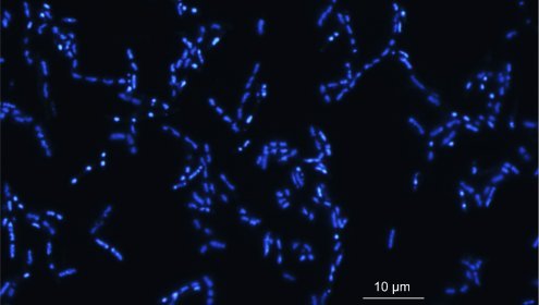 Imagen de microscopía de epifluorescencia donde se observan bacterias marinas cultivadas y con tinción DAPI / ICM-CSIC