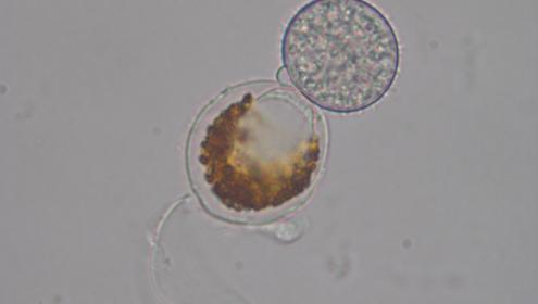 Célula de dinoflagelado infectada por el quítrido ectoparásito Ericiomyces syringoforeus / Albert Reñé (ICM-CSIC)