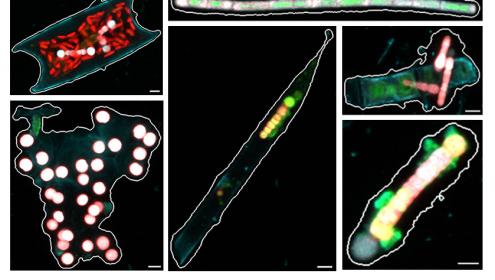 Imágenes de microscopía confocal de las múltiples formas que presentan algunos cianobacterias fijadoras de nitrógeno en el océano / R.A. Foster.