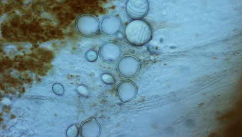 Los cnidocitos son las células urticantes de las medusas / ICM-CSIC.
