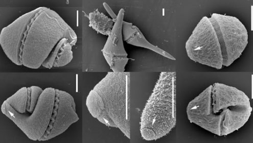 ICM’s scientists find out a new family of microalgae
